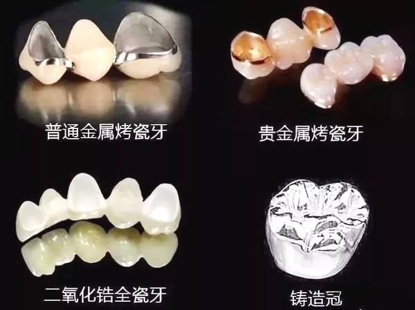 常德美奧口腔鉅惠看牙,韓國登騰種植牙3980元起,自鎖托槽矯正享5折優(yōu)惠！
