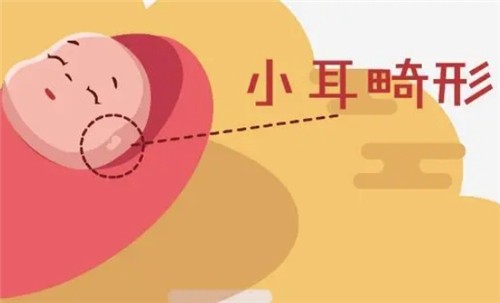 【河南中醫(yī)藥大學一附院】莊洪興教授暑假坐診，耳畸形修復(fù)限時預(yù)約！