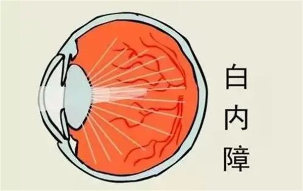 上海醫(yī)大眼科白內(nèi)障手術(shù)8千-3萬起，不同品牌晶體價(jià)格有些許差異