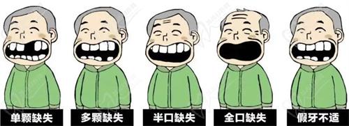杭州種植牙哪家醫(yī)院好？