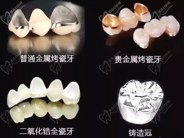 常德美奧口腔鉅惠看牙,韓國登騰種植牙3980元起,自鎖托槽矯正享5折優(yōu)惠！