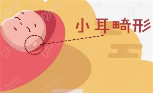 【河南中醫(yī)藥大學(xué)一附院】莊洪興教授暑假坐診，耳畸形修復(fù)限時(shí)預(yù)約！