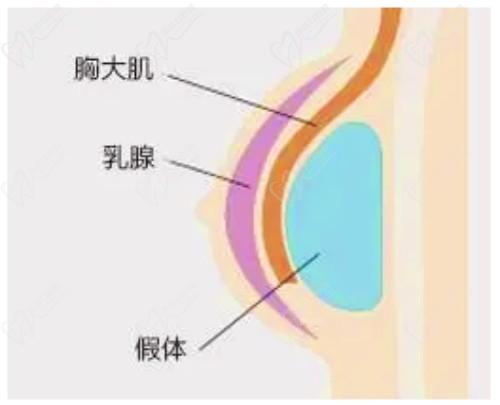 米蘭柏羽開啟胸部醫(yī)生面診日，穆大力、李英大親診做出精致自然美胸